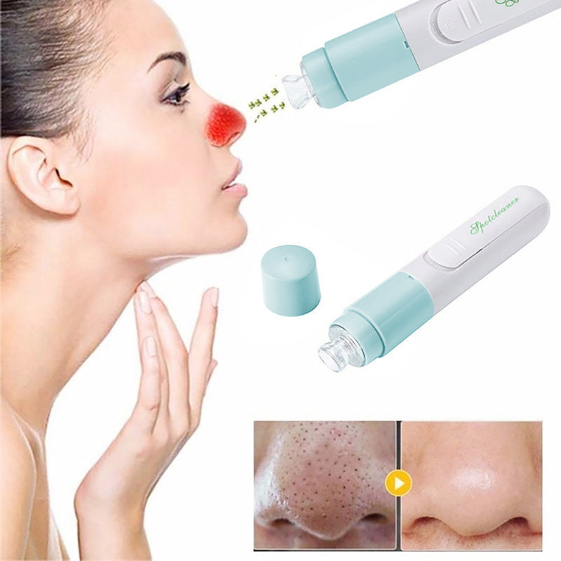 Cleaner Vacuum Suction Facia Blackhead Removal Skin Care Cleansing Tool