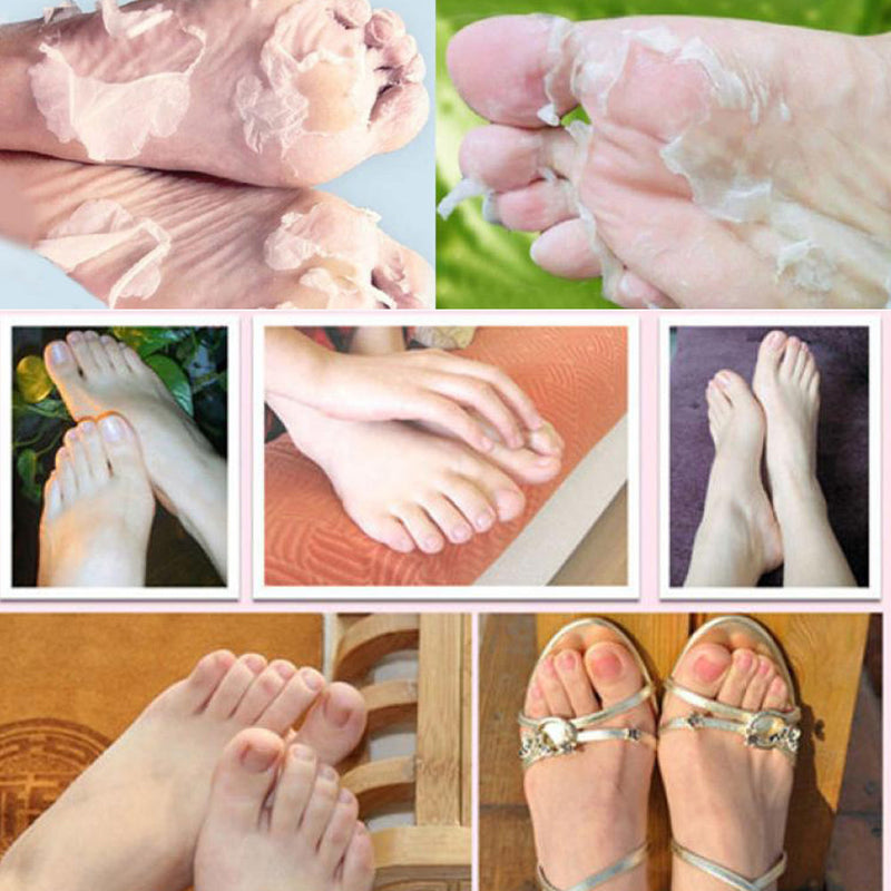 Hot Remove Dead Skin Foot Mask Peeling Cuticles Heel Feet Care Anti Aging